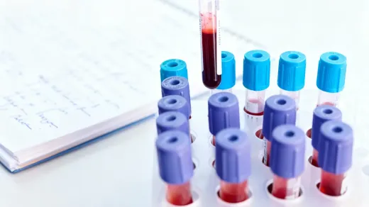 Hamilelikte ikili üçlü ve dörtlü test